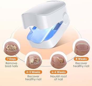 Nail Fungus Cleaning Laser Device