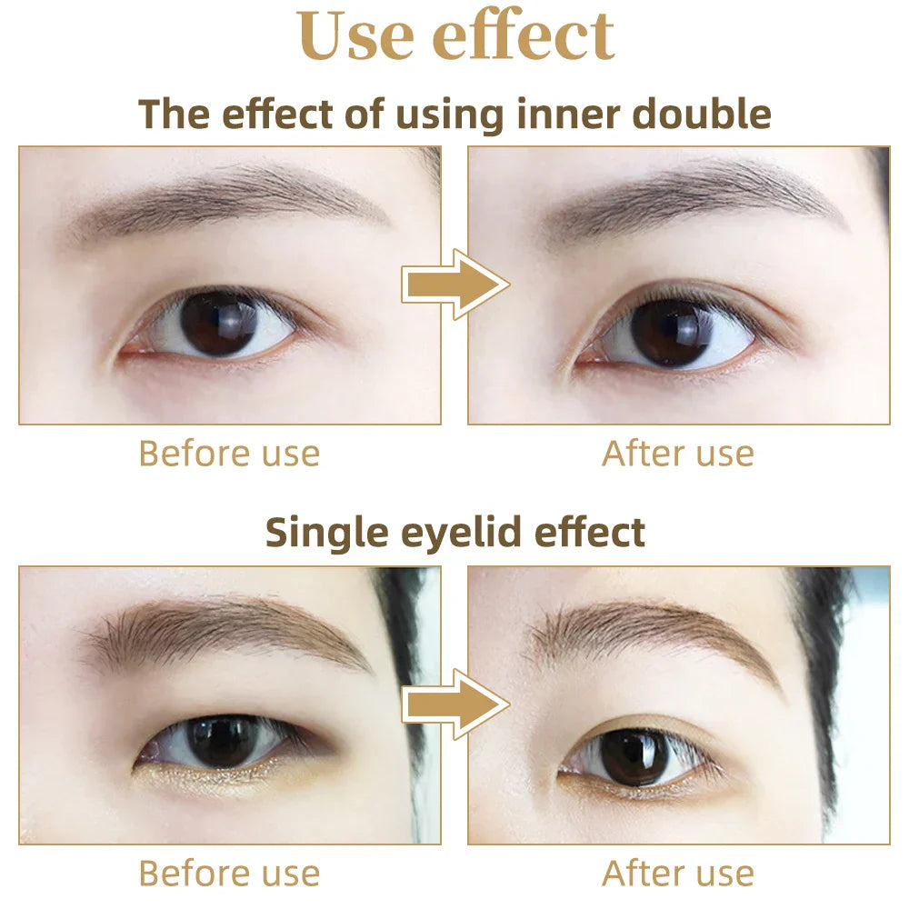 Transparent Eyelid Strips