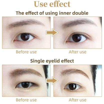 Transparent Eyelid Strips