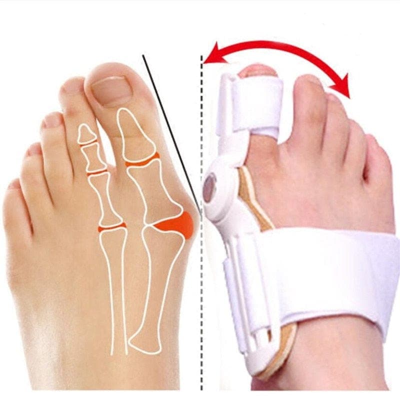 ORTHOPAEDIC BUNION CORRECTOR