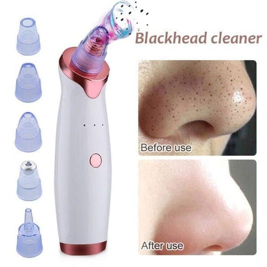 ACNE REMOVER