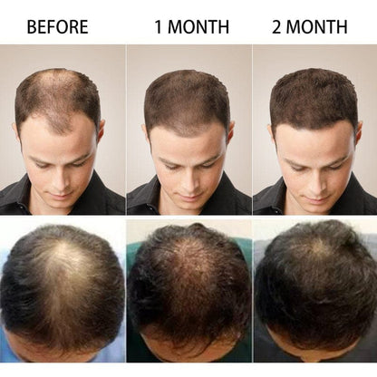 HAIR GROWTH SERUM